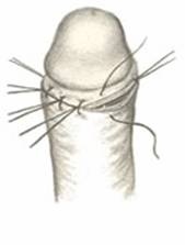 Топ-8 кошмарных средств против мастурбации
